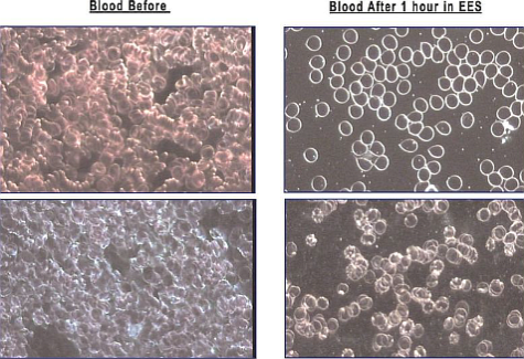 Detoxified Blood Detoxified Blood